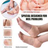 Half Heel Pain Anti-Crack Silicone Set – Unisex Anti-Crack Pain Relief - 01 Pair
